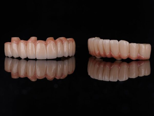 Multilayer Zirkonyum (CAD/CAM)